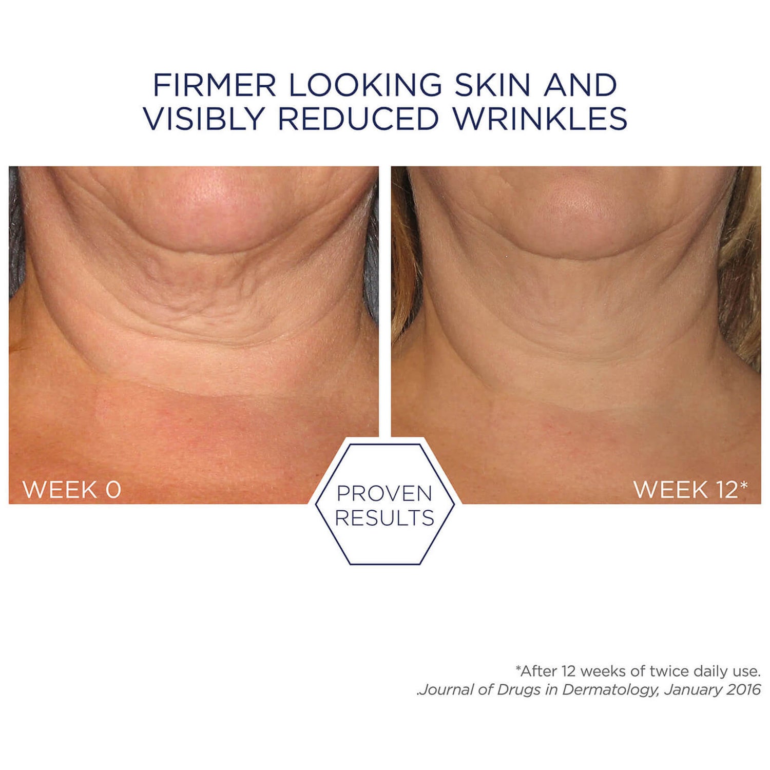 15 Best Neck Creams of 2024 for Firming Skin