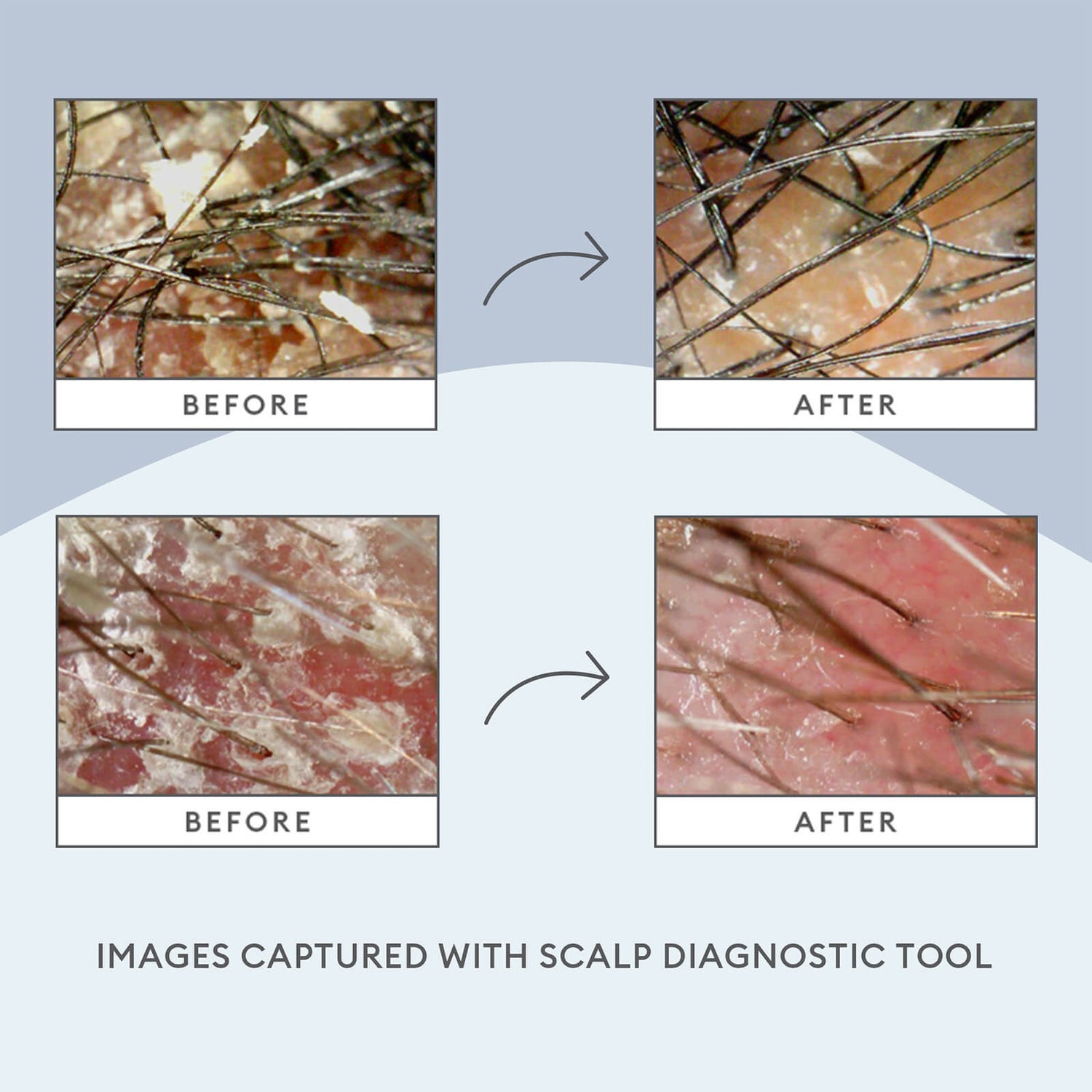Itchy dry flaky deals scalp