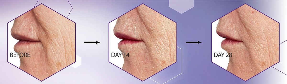 Firmer looking skin within 28 days†