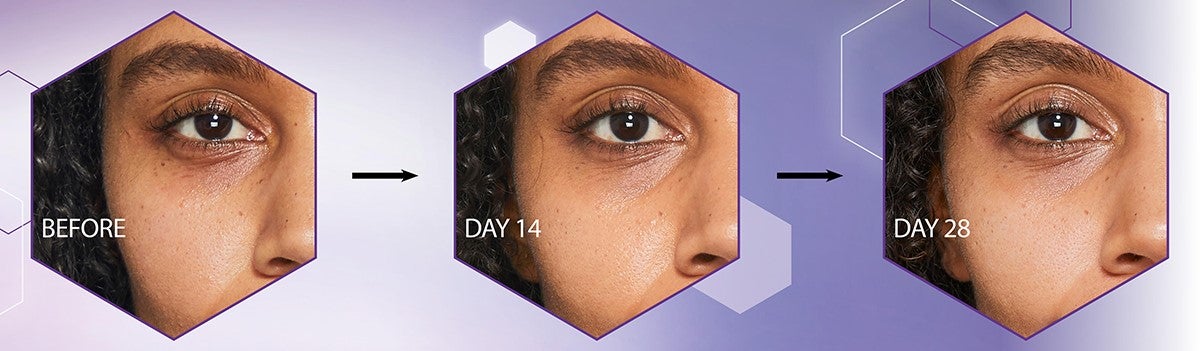 Healthier, younger looking skin within 28 days