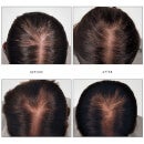 René Futerer RF 80 Concentrated Hair Loss Treatment traitement perte des cheveux (12 fioles)