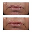 Perricone MD No Makeup Skincare Lipstick 0.15oz (Various Shades)