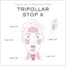TriPollar STOP X Device - Rose Gold