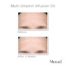 Murad Hydrate Trial Kit 2.83 fl. oz. - $58 Value
