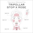 TriPollar STOP X ROSE Ombre