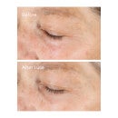 Murad Vitamin C Triple Exfoliating Facial Peel 2.7 fl. Oz