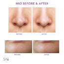 Spa Sciences MIO Diamond Microdermabrasion And Pore Extraction Skin Resurfacing System (Various Shades)