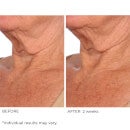 NassifMD Dermaceuticals Intense Hydration Face and Body Soufflé Light-Weight Moisturising Cream 120ml