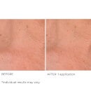 NassifMD Dermaceuticals Intense Hydration Face and Body Soufflé Light-Weight Moisturising Cream 120ml