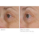 NassifMD Dermaceuticals Peri-Orbital Eye Complex Revitalising and Regenerating Eye Cream 30ml