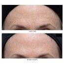 Dr Dennis Gross Skincare Ferulic + Retinol Wrinkle Recovery Peel