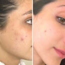 Yon-Ka Paris Skincare SOS Spot Blemish Treatment 15ml