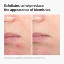 محلول حمض الساليسيليك 2% من The Ordinary (30 مل)