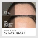 FaceGym Active Blast Instant Release Collagen Booster Spheres (Various Options)