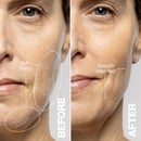 DERMAFLASH Luxe+ Advanced Sonic Dermaplaning and Peach Fuzz Removal - Stone