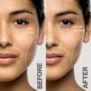 DERMAFLASH Luxe+ Advanced Sonic Dermaplaning and Peach Fuzz Removal - Stone