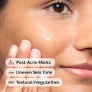 The Ordinary Aloe 2% + NAG 2% Solution Serum 30ml