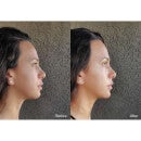 FOREO BEAR 2 Facial Toning Device - Fuchsia