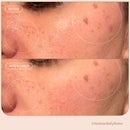 Biossance Squalane + 1% Azelaic Pore Minimising Mask 75ml