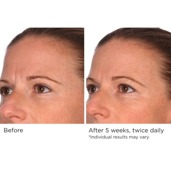 NassifMD Dermaceuticals Hydration Serum with Micro-Spheres of Hyaluronic Acid and Ceramides 120ml 3