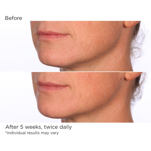 NassifMD Dermaceuticals Hydration Serum with Micro-Spheres of Hyaluronic Acid and Ceramides 120ml 2