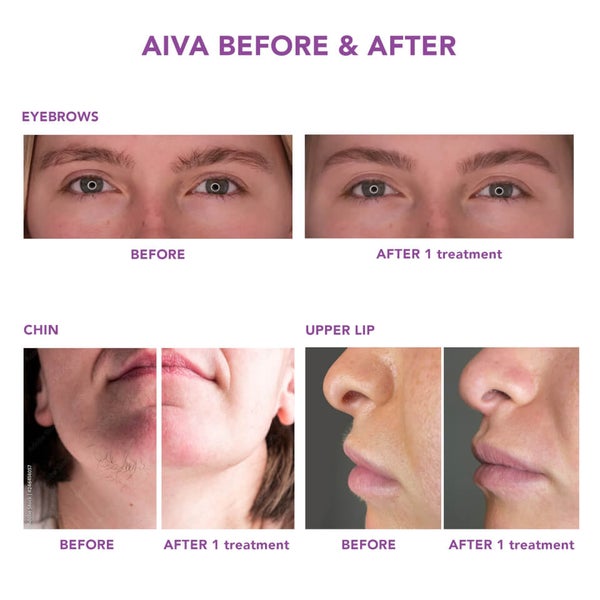Spa Sciences AIVA Facial Hair Remover and Eyebrow Trimmer - Black 2