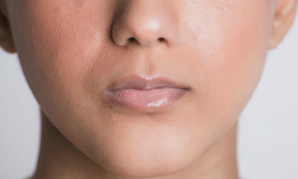The Best Treatments for Lip Lines and Wrinkles