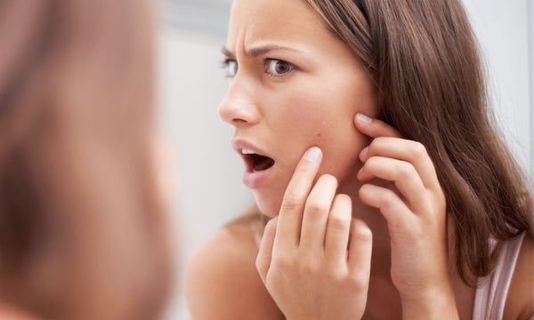 Whiteheads vs. Blackheads: Battle of the Blemishes