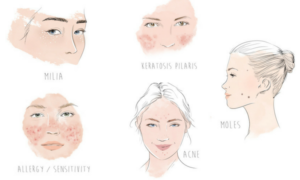 What Are Those Tiny Bumps on Your Face? 5 Possibilities