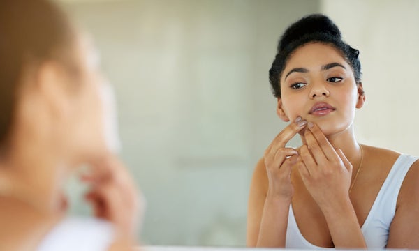 How to Get Rid of Cystic Acne