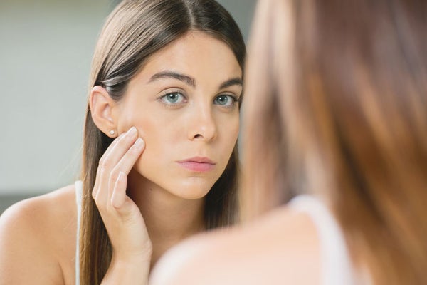 6 Common Myths About Rosacea, Debunked