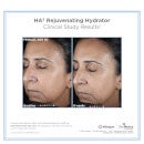 SkinMedica HA5 Rejuvenating Hydrator and HA5 Smooth and Plump Lip System
