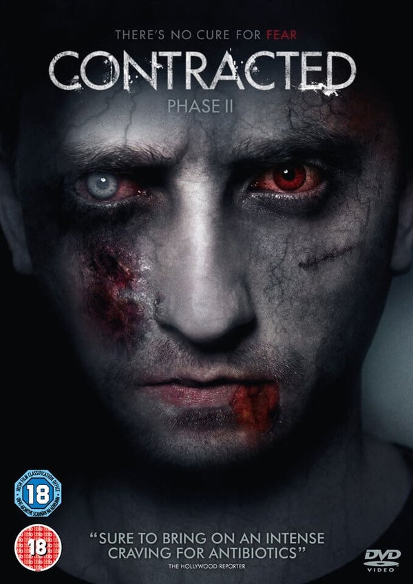 Contracted Phase 2