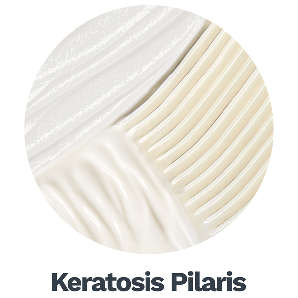 Keratosis Pilaris