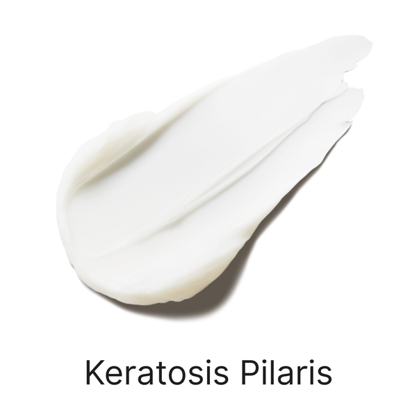 Keratosis Pilaris