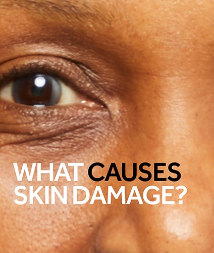 Your Skin Damage Questions Answered
