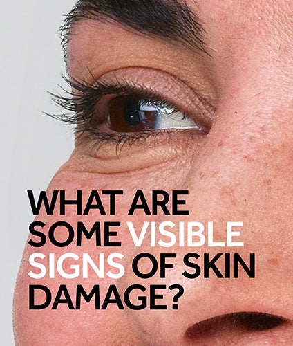 Your Skin Damage Questions Answered