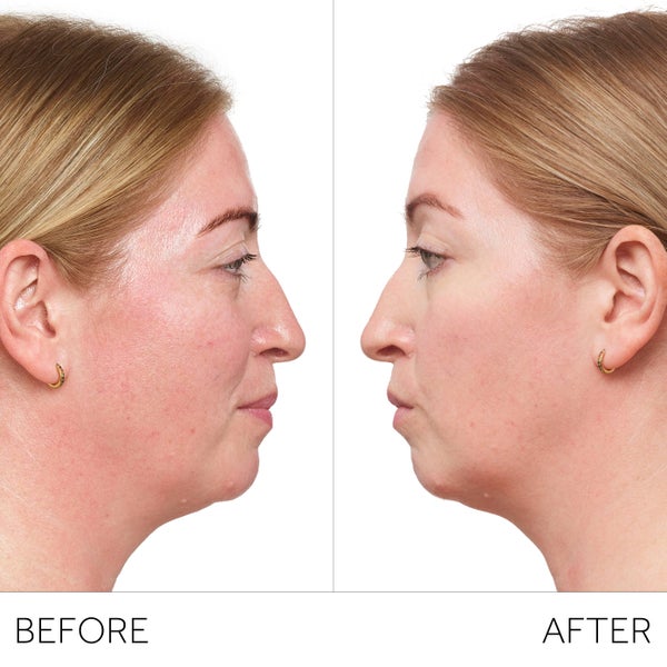 Visible results