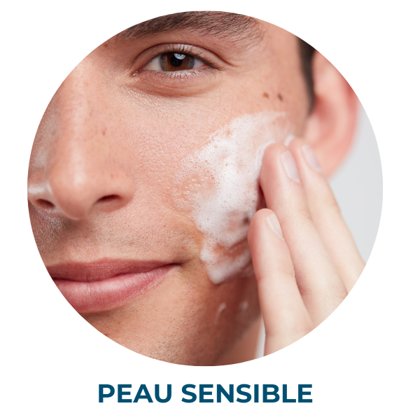 Peau sensible