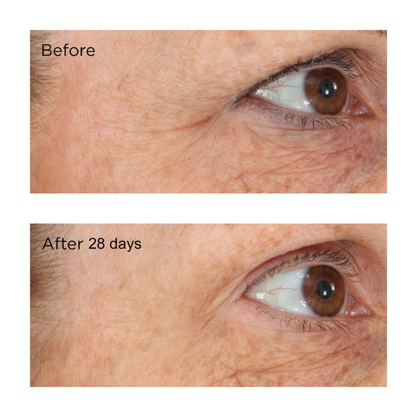 Image of Essential Fx Acyl-glutathione  eyelid lift serum before and after 28 days