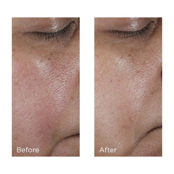 NO:RINSE Intensive Pore Minimizing Toner Before and After Images