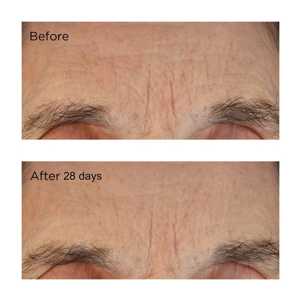 image of Essential Fx Acyl-glutathione deep crease serum before and after 28 days