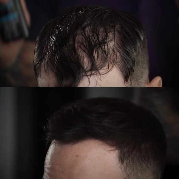 Before and after of man's head with less hair and fuller hair Visit Our Instagram