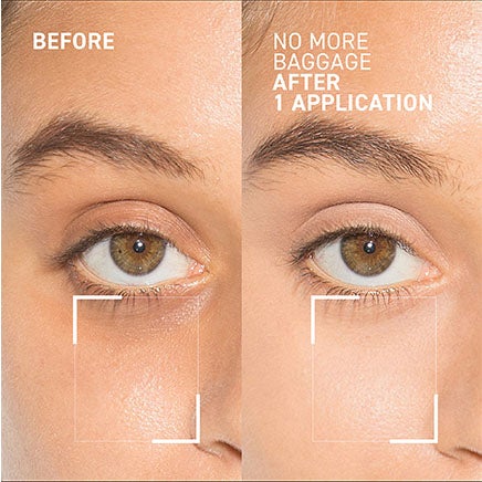Visit our Instagram. Before and After Triple Active Retinol After 4 Weeks.