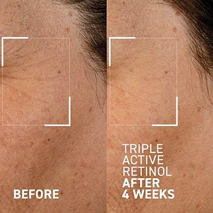 Visit our Instagram. Before and After Triple Active Retinol After 4 Weeks.