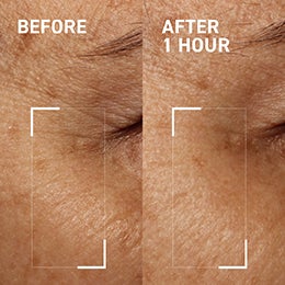 needles no more wrinkle smoothing cream before and after