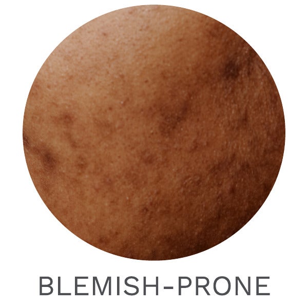 Dermatological Skincare for Blemish-Prone Skin