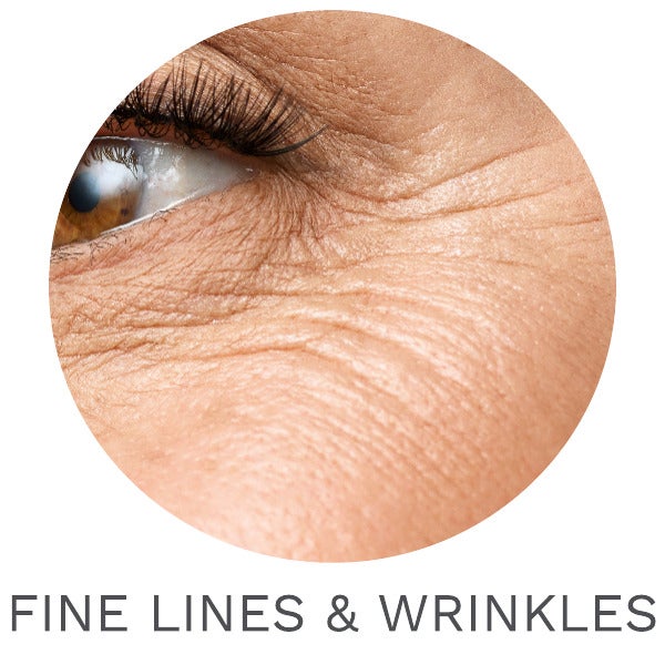 FINE LINES & WRINKLES