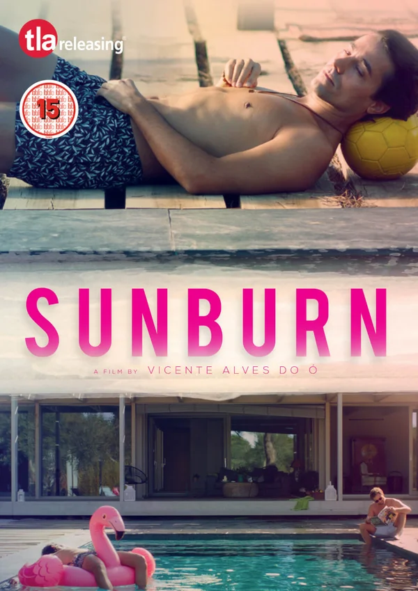 Sunburn