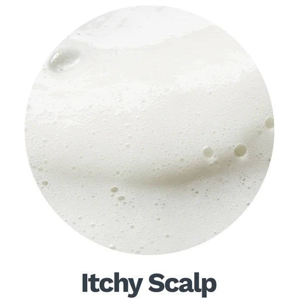 Itchy Scalp
